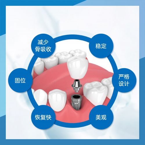 法国安卓健种植（全瓷）
